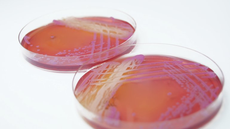 Das Bild zeigt die Bakterienart Staphylococcus aureus in einer Petrischale.