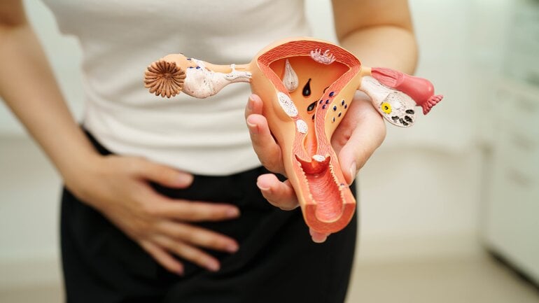 Geschlechtskrankheit: Trichomonaden-Infektion (Modell weiblicher Geschlechtsteile)