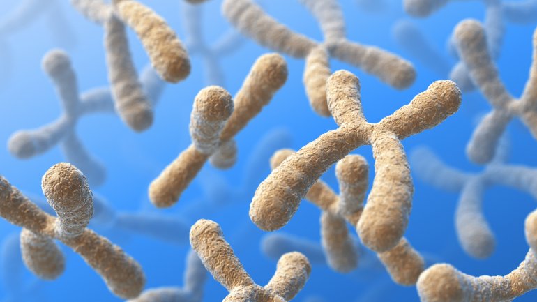 TurnerSyndrom (UllrichTurnerSyndrom)