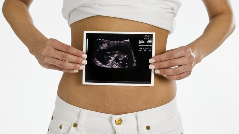 Das Bild zeigt eine Frau, die ein Foto von einer Ultraschallaufnahme hochhält.