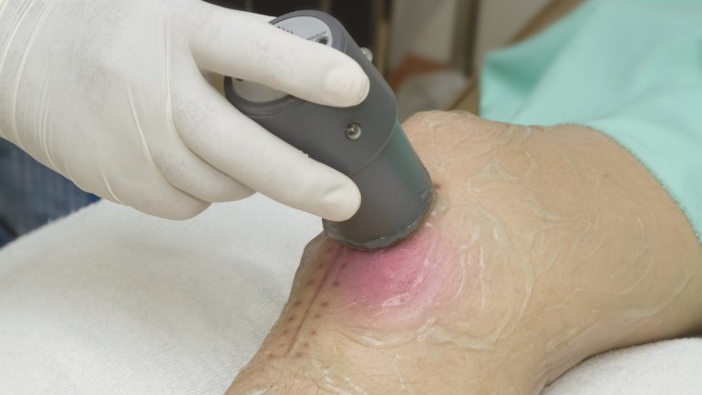 Ein Therapeut behandelt das Knie eines Patienten mit Ultraschalltherapie.
