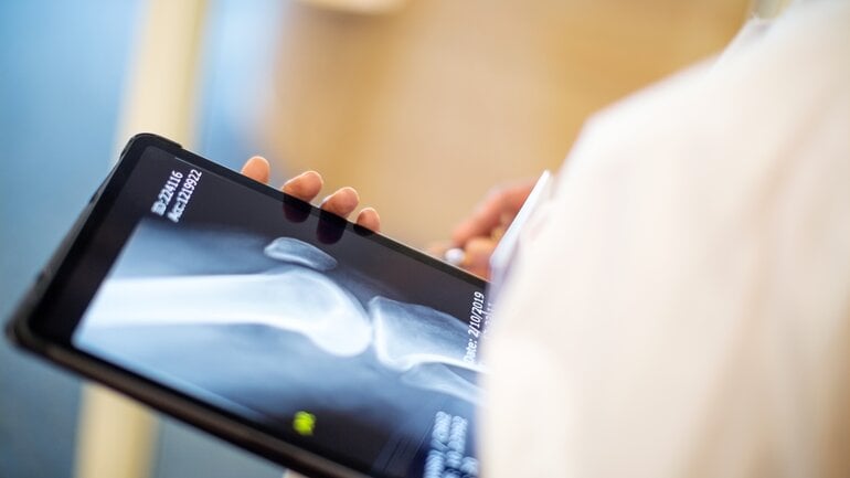 Knochenschwäche: Symptom bei langfristigem Vitamin-K-Mangel