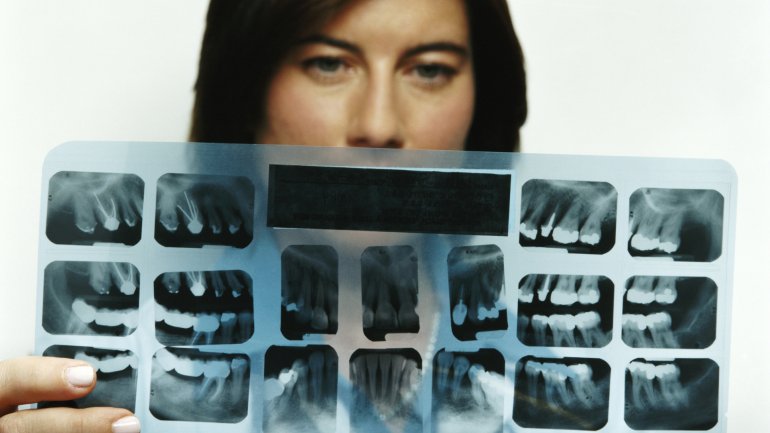 Das Bild zeigt eine Frau mit einem Röntgenbild von Zähnen.