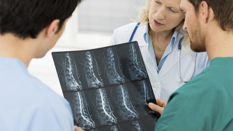 Das Bild zeigt Röntgenaufnahmen einer Wirbelsäule.