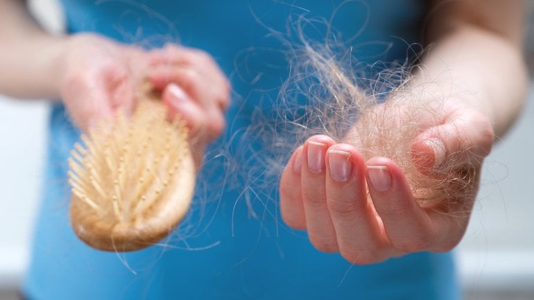 Haarausfall bei Chemotherapie ist mögliche Nebenwirkung Haarausfall bei Chemotherapie ist mögliche Nebenwirkung